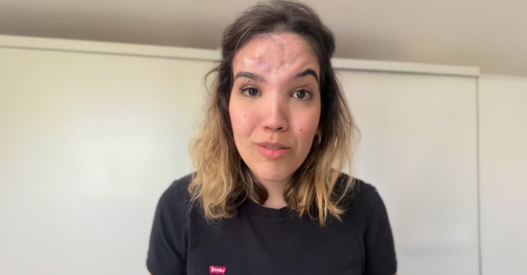 Advogada atacada com pedra faz "vakinha" para tratamento nos EUA