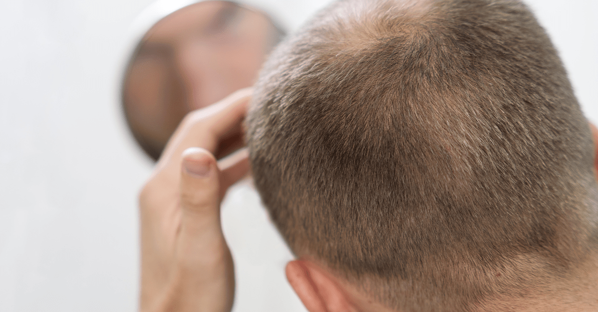 TJ/DF: Empresa indenizará por propaganda enganosa de tônico capilar